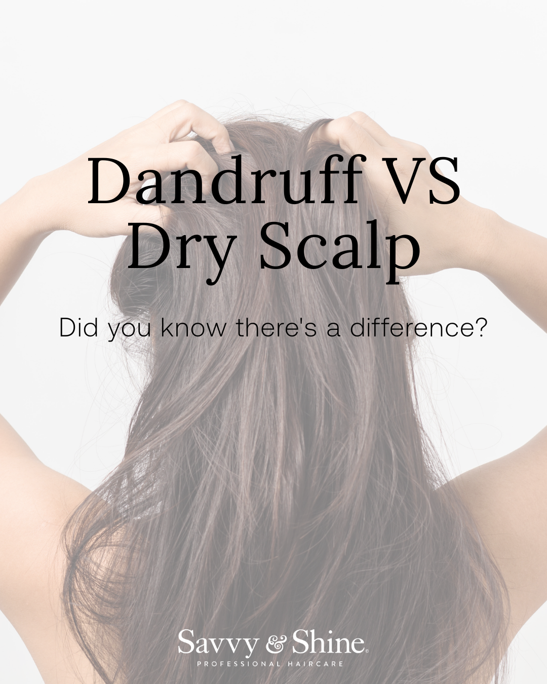 Dandruff vs. Dry Scalp Flakes: What’s the Difference?